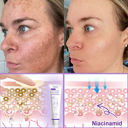 Celsiora® PDRN Multi-Peptide Körpercreme gegen Falten, schlaffe Haut, Dehnungsstreifen & Cellulite