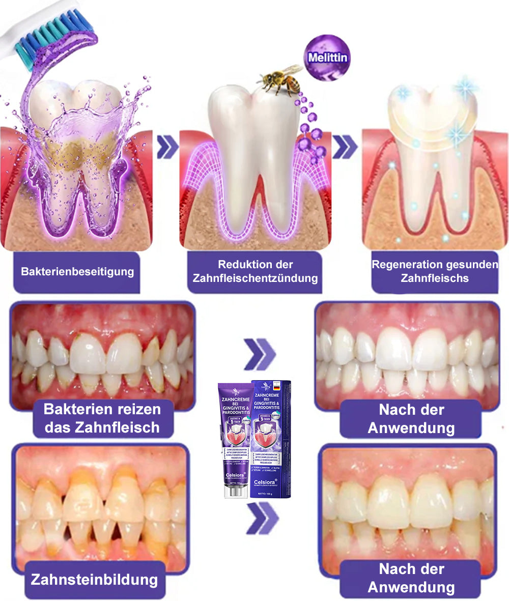 🌿Celsiora® GingivaCare Zahnpasta mit Bienengift – Intensive Zahnfleischpflege bei Gingivitis & Parodontitis