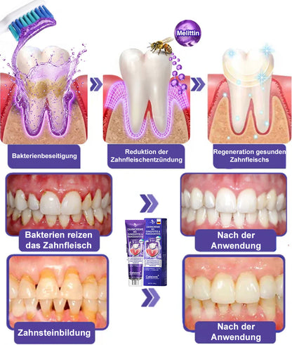🌿Celsiora® GingivaCare Zahnpasta mit Bienengift – Intensive Zahnfleischpflege bei Gingivitis & Parodontitis