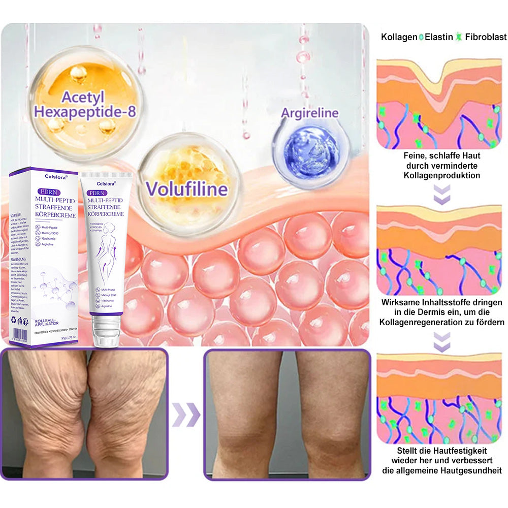 Celsiora® PDRN Multi-Peptide Körpercreme gegen Falten, schlaffe Haut, Dehnungsstreifen & Cellulite