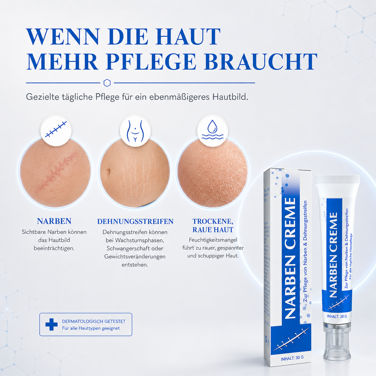 Kalovino® Reparierende Narbenpflege-Creme gegen Dehnungsstreifen, Aknenarben & unebenes Hautbild – für glatter und ebenmäßiger wirkende Haut