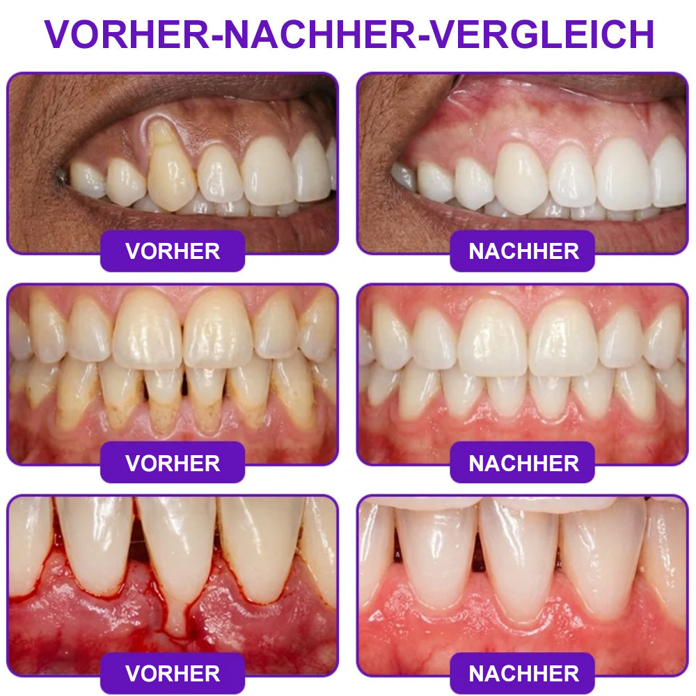 🌿Celsiora® GingivaCare Zahnpasta mit Bienengift – Intensive Zahnfleischpflege bei Gingivitis & Parodontitis