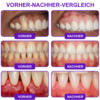 🌿Celsiora® GingivaCare Zahnpasta mit Bienengift – Intensive Zahnfleischpflege bei Gingivitis & Parodontitis
