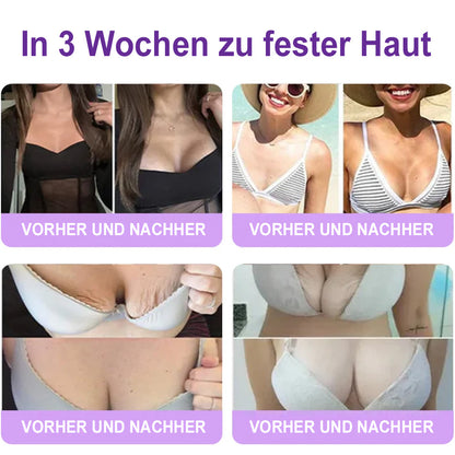 Celsiora® PDRN Multi-Peptide Körpercreme gegen Falten, schlaffe Haut, Dehnungsstreifen & Cellulite