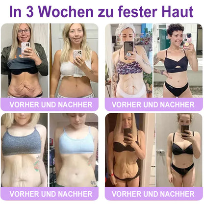 Celsiora® PDRN Multi-Peptide Körpercreme gegen Falten, schlaffe Haut, Dehnungsstreifen & Cellulite