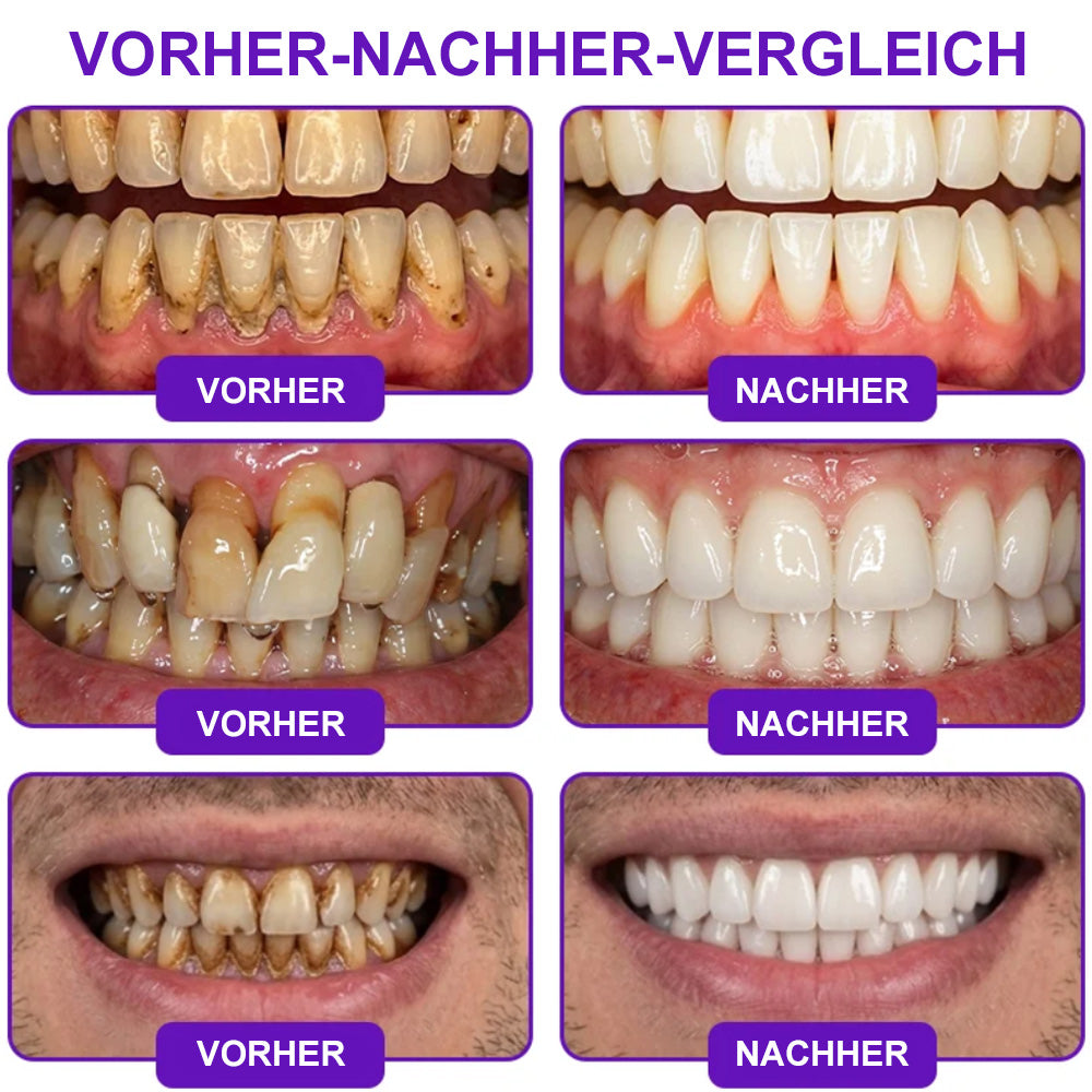 🌿Celsiora® GingivaCare Zahnpasta mit Bienengift – Intensive Zahnfleischpflege bei Gingivitis & Parodontitis