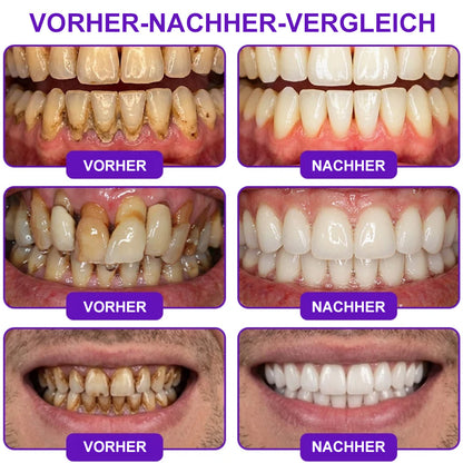 🌿Celsiora® GingivaCare Zahnpasta mit Bienengift – Intensive Zahnfleischpflege bei Gingivitis & Parodontitis