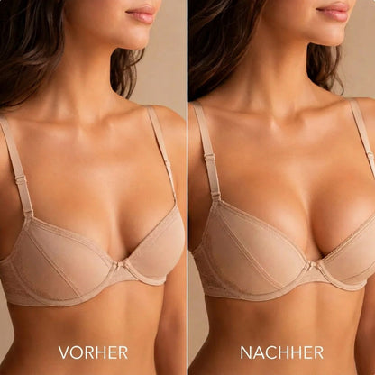 up Celsiora® Mikronadel-Pflaster zur Brustverschönerung