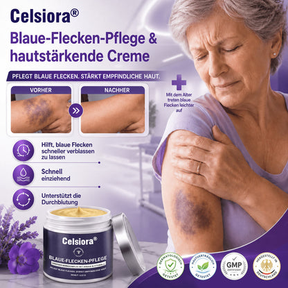 up Celsiora® Bruise Repair Cream – Intensivpflege bei sichtbaren Blutergüssen, dünner und empfindlicher Haut