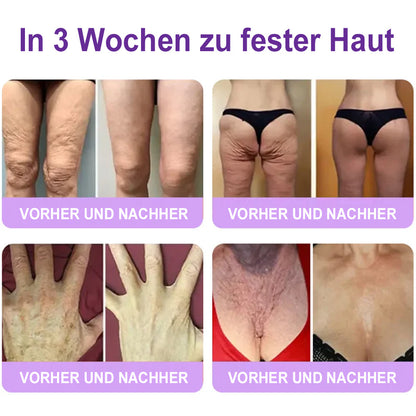 Celsiora® PDRN Multi-Peptide Körpercreme gegen Falten, schlaffe Haut, Dehnungsstreifen & Cellulite