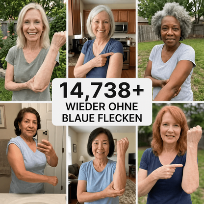 up Celsiora® Bruise Repair Cream – Intensivpflege bei sichtbaren Blutergüssen, dünner und empfindlicher Haut