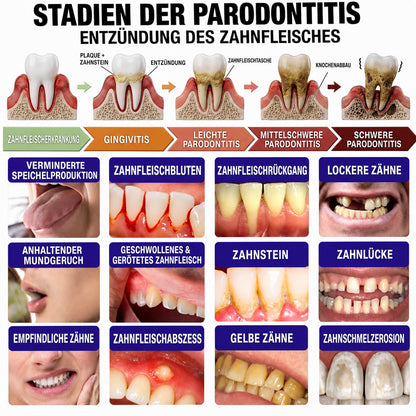 🌿Celsiora® GingivaCare Zahnpasta mit Bienengift – Intensive Zahnfleischpflege bei Gingivitis & Parodontitis