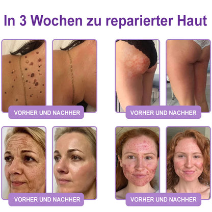 Celsiora® PDRN Multi-Peptide Körpercreme gegen Falten, schlaffe Haut, Dehnungsstreifen & Cellulite