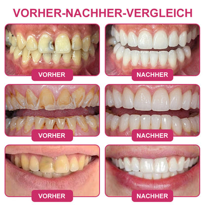 🦷 Kalovino® Zahnschmelz Pflege Gel – Für starke & empfindliche Zähne