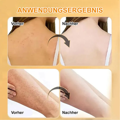 🆙✨ Kalovino® Kurkuma Körperpeeling für strahlende Haut