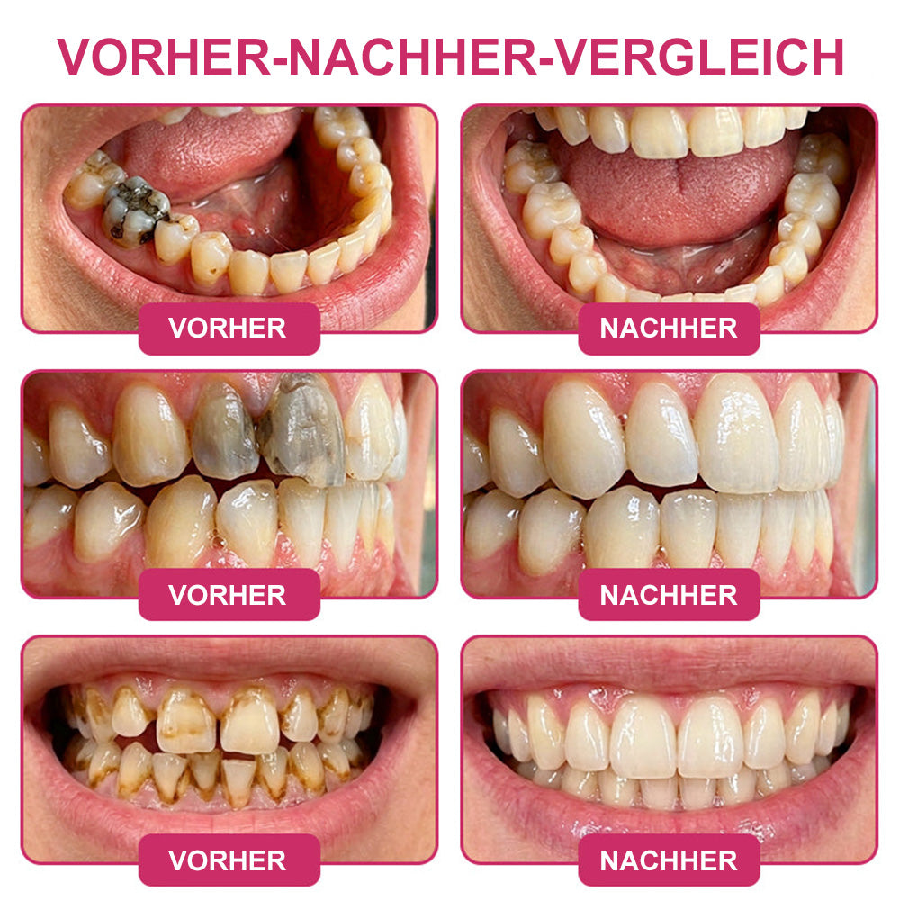 🦷 Kalovino® Zahnschmelz Pflege Gel – Für starke & empfindliche Zähne