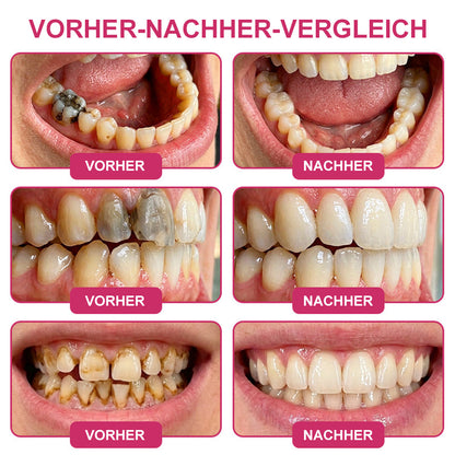 🦷 Kalovino® Zahnschmelz Pflege Gel – Für starke & empfindliche Zähne