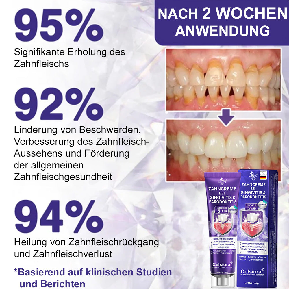 🌿Celsiora® GingivaCare Zahnpasta mit Bienengift – Intensive Zahnfleischpflege bei Gingivitis & Parodontitis