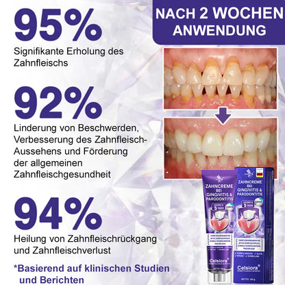 🌿Celsiora® GingivaCare Zahnpasta mit Bienengift – Intensive Zahnfleischpflege bei Gingivitis & Parodontitis