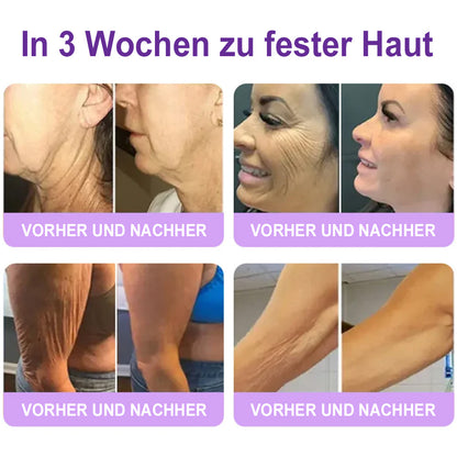 Celsiora® PDRN Multi-Peptide Körpercreme gegen Falten, schlaffe Haut, Dehnungsstreifen & Cellulite