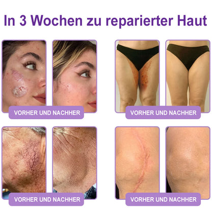Celsiora® PDRN Multi-Peptide Körpercreme gegen Falten, schlaffe Haut, Dehnungsstreifen & Cellulite
