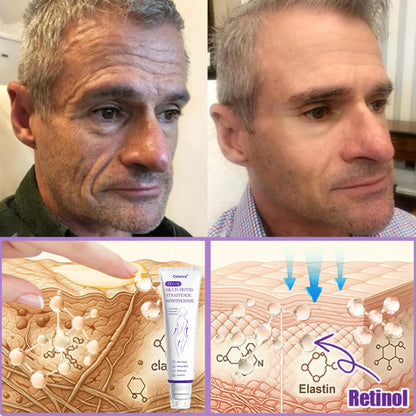 Celsiora® PDRN Multi-Peptide Körpercreme gegen Falten, schlaffe Haut, Dehnungsstreifen & Cellulite