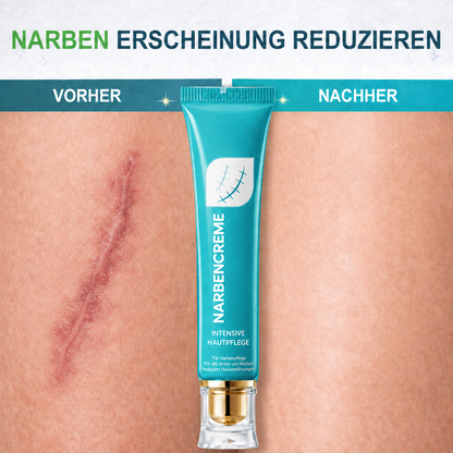 🌿✨ Kalovino® Narbencreme – Für sichtbar glattere Haut