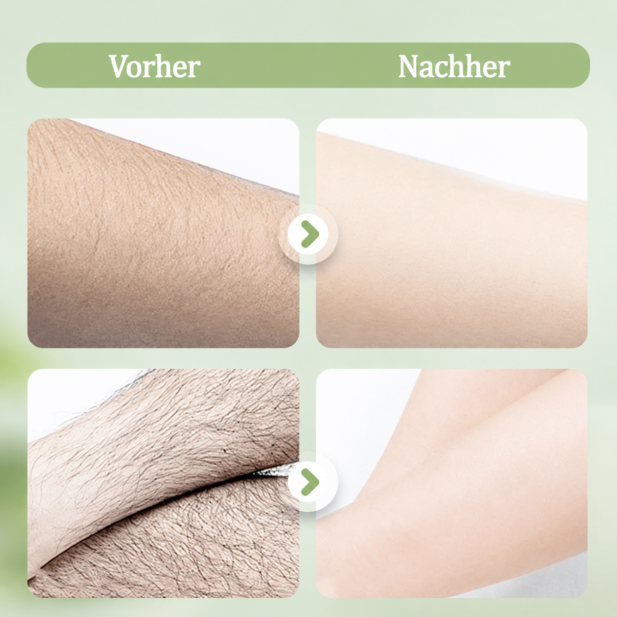 up  Kalovino® Sanfte Haarentfernungscreme für empfindliche Haut