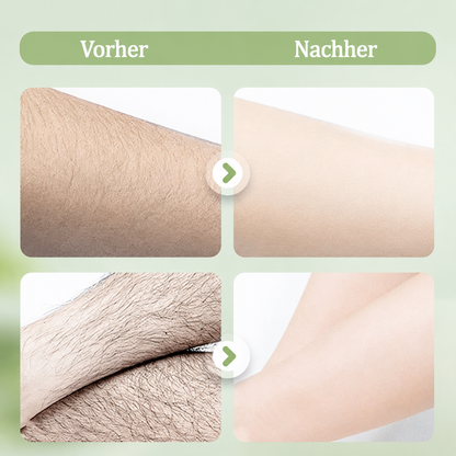 up  Kalovino® Sanfte Haarentfernungscreme für empfindliche Haut