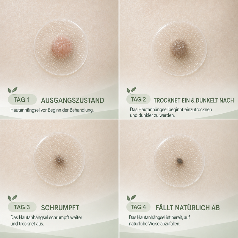 🌿 Kalovino® Effektive botanische Mikronadel-Pflaster zur gezielten Pflege kleiner Hautanhängsel