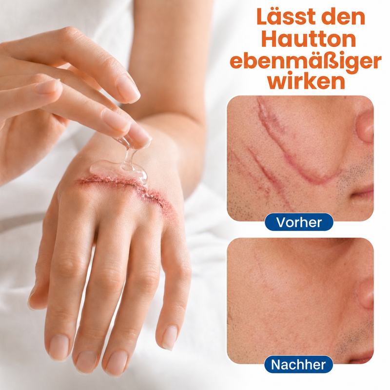 💧 ✨Kalovino®Intensiv-Hauterneuerungs-Gel – für straffer & glatter wirkende Haut